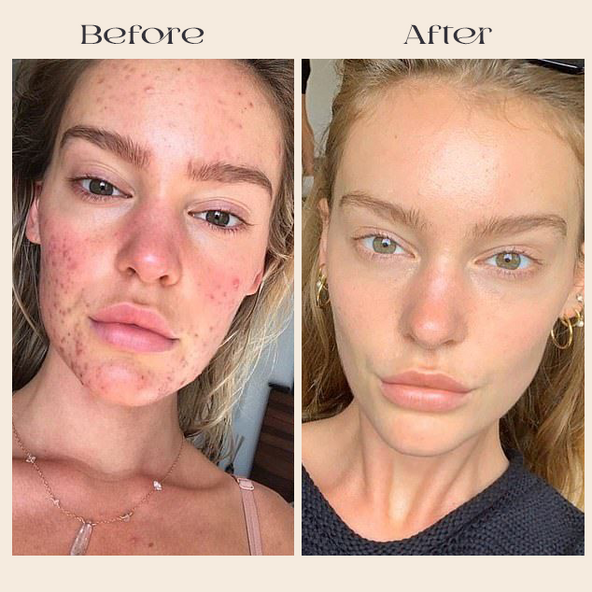 CELLNAISSANCE™ DE KB-Beauty Day & Night Collagen Cream