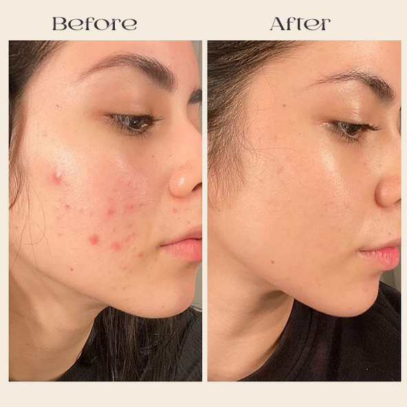 CELLNAISSANCE™ DE KB-Beauty Day & Night Collagen Cream