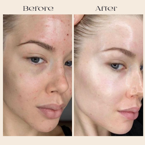 CELLNAISSANCE™ DE KB-Beauty Day & Night Collagen Cream
