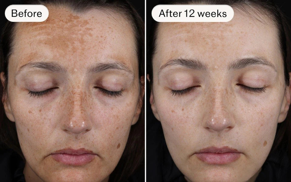CELLNAISSANCE™ DE KB-Beauty Day & Night Collagen Cream